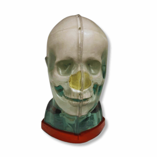 MR Fusion Head Phantom