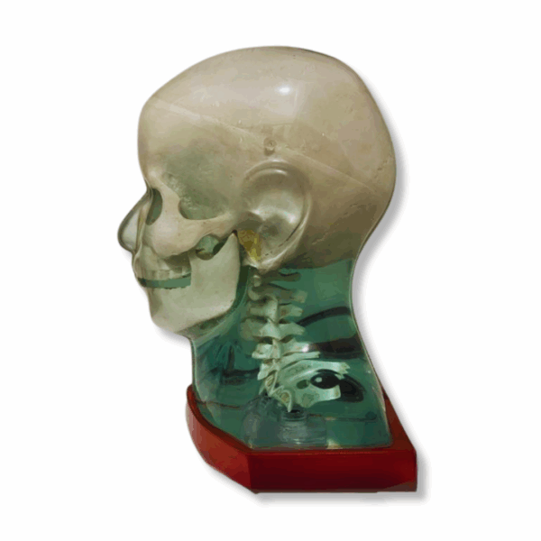 MR Fusion Head Phantom_Left Side
